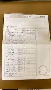 서울성모병원 후발백내장 레이저시술 후기 (9) 검사결과
